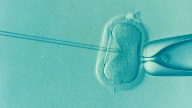 高倍显微镜下的卵子正在行单精子注射术